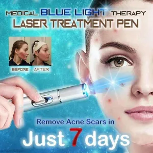 Face Acne Laser Pen